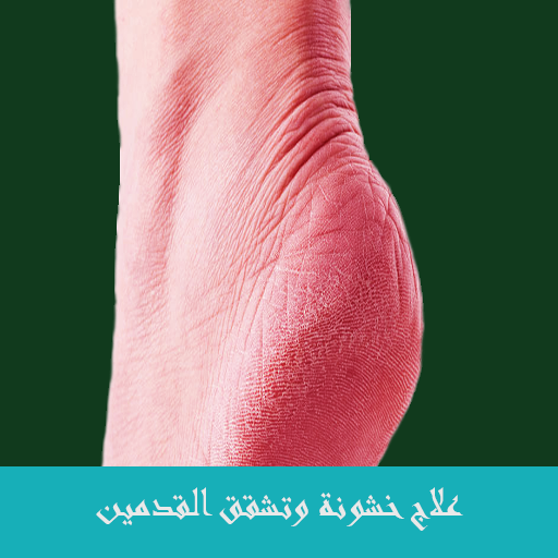 علاج خشونة وتشقق القدمين logo