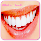 How to Whiten Teeth icon