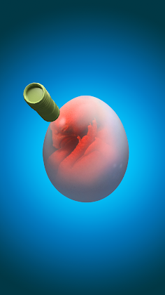 Hatching Master - Screenshot 3