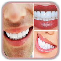 Teeth Whitening Tips How to Remove Teeth Stains