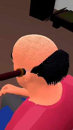 Hair Transplant 3D Game - Screenshot 1
