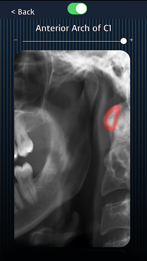 Dental Panoramic Radiology Screen 3