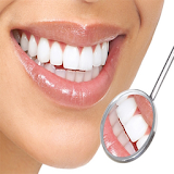 وصفات تبيض الاسنان مجربة icon