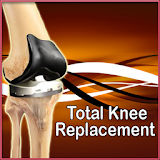 Total Knee Replacement icon