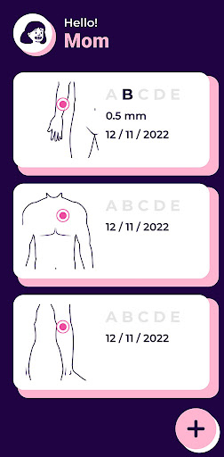 MoleControl - Family Skincare Screen 3