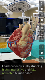 INSIGHT HEART Ekran Görüntüsü