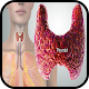 Thyroid Symptoms Treatment Изтегляне на Windows