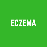 Eczema Causes Treatment Symptoms and Prevention