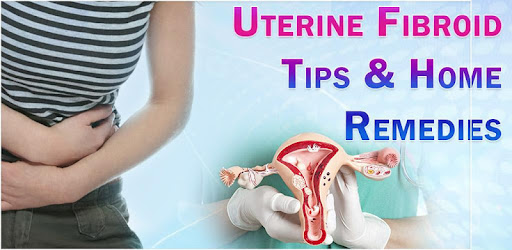 Uterine Fibroid Treatment Help