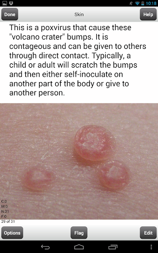 COMLEX Level 1 Flashcards Lite