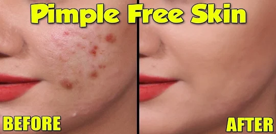 Cleansing skin from pimples