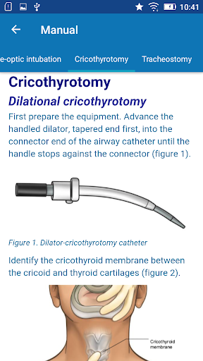 Airway Management- BeyondBasic Screen 2