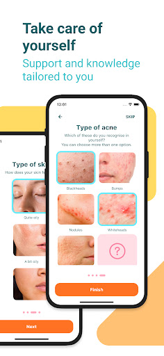Koru - your acne coach Screen 3