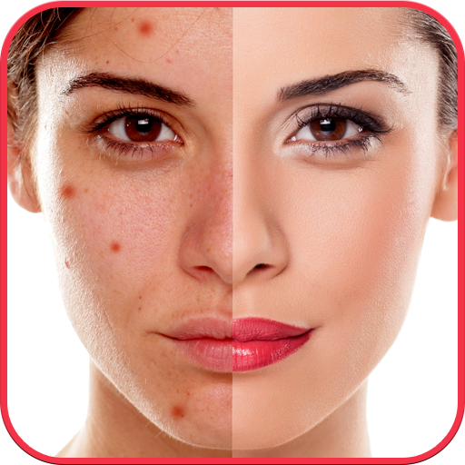 Blemishes Remover You Makeup Logo