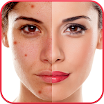 Blemishes Remover You Makeup Apk