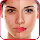 Blemishes Remover You Makeup Download on Windows