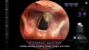 Airway Ex: Anesthesiology Game