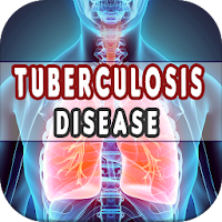 Tuberculosis Causes Diagnosi