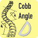Cobb Angle App