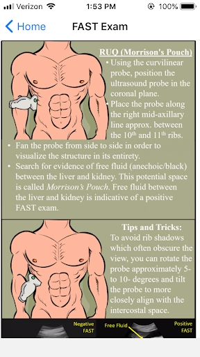 EM Ultrasound Screen 2