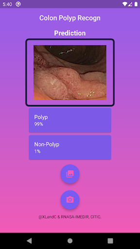 Colon Polyp Recogn Screen 2