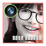 Real Cute Brace Editor icon