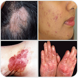 All Skin Diseases and Treatments- A to Z icon