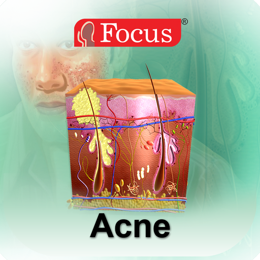 Acne logo