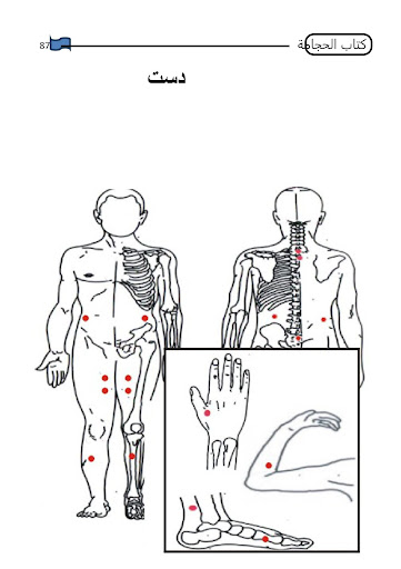 Android application Hijama کتاب الھجامہ screenshort