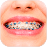Braces Booth - Funny Stickers icon