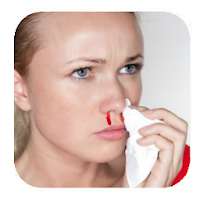 Nose Bleeding Remedies