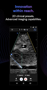 Butterfly iQ — Ultrasound