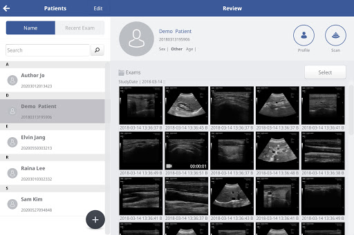 SONON X Ultrasound App Screen 3