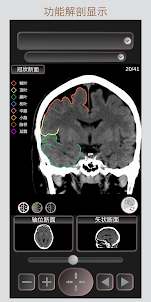 CT 护照 "头部" / 剖面解剖/ MRI