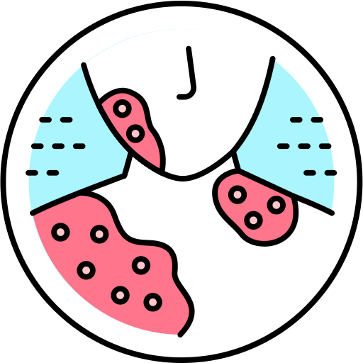 Псориаз причины и лечение logo