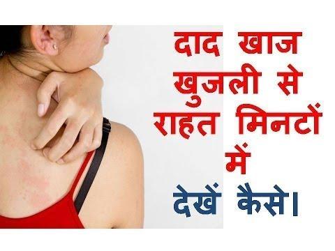 खुजली के इलाज Khujli Ke Ilaj K Screenshot 1 - AppWisp.com