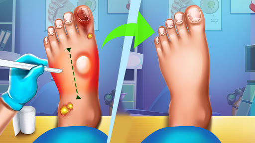 لعبه Foot Care Offline Doctor Games apk مهكر2