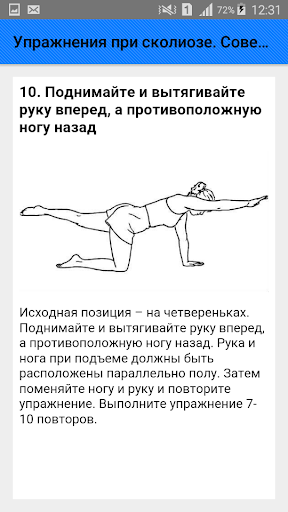 Упражнения при сколиозе. Совет
