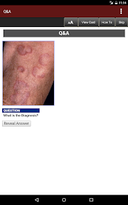 Screenshot 15 Fitzpatrick's Dermatology Flas android