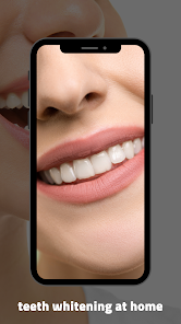 teeth whitening at home 1 APK + Мод (Unlimited money) за Android