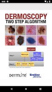 Dermoscopy Two Step Algorithm Unknown