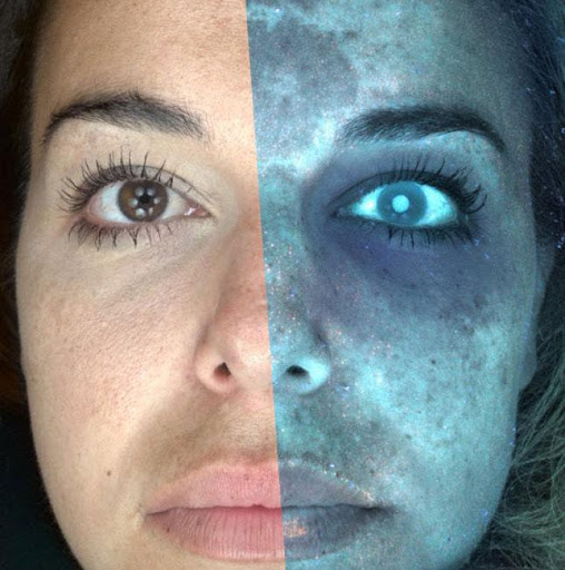 DermIA - Analyze Skin Cancer with your camera A.I