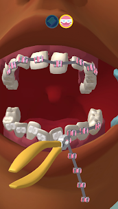 Perfect Smile 3D MOD APK (No Ads) Download 5