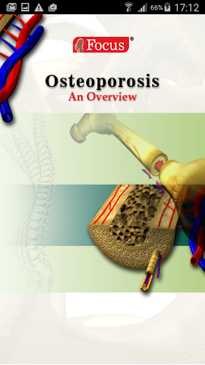 Android application Osteoporosis screenshort