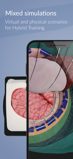UpSurgeOn Neurosurgery Screen 3