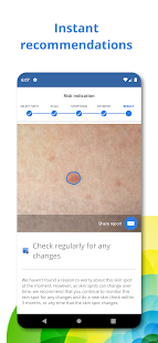 SkinVision - Detect Skin Cancer. Track your Moles. 6.10.0 Screenshots 3