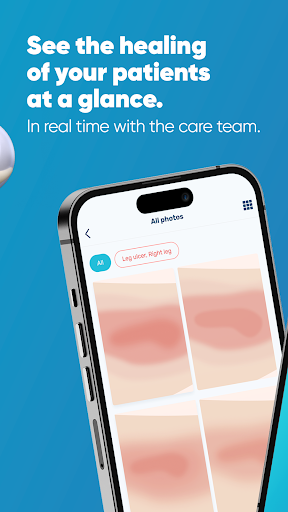 Healico Screen 3