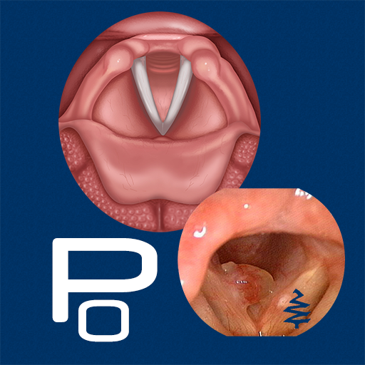 Polyps دانلود در ویندوز