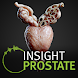 INSIGHT PROSTATE - Androidアプリ