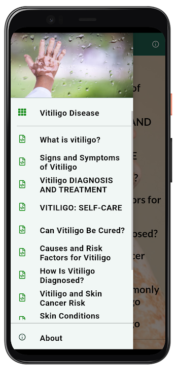 Vitiligo Disease and treatment - 2.0.0 - (Android)